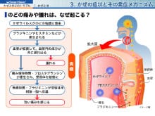 動画教材イメージ（のどの痛みや腫れは、なぜ起こる？）